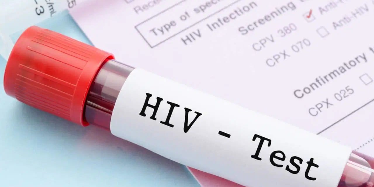 Türkiye’de HIV alarmı: Sessiz pandemi